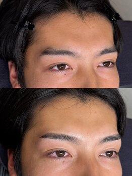 ソート 水戸(soat)/ワックス脱毛のみ