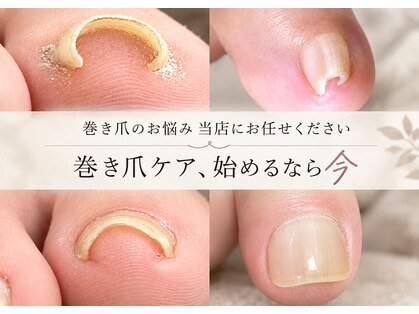 ゾゾ イリプレッセブル(ZOZO irreplaceable)の写真