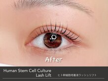 アンモス 日本橋店(Ann Moss)/ヒト幹細胞培養液ラッシュリフト