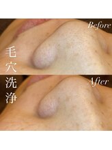 アース コアフュールボーテ 新潟紫竹山店(EARTH coiffure beaute)/毛穴洗浄