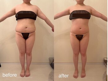 クロレ 浦和店(CLORE)/30代のお客様/7回施術