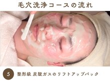 ファン(FAN)/毛穴洗浄 《施術の流れ》