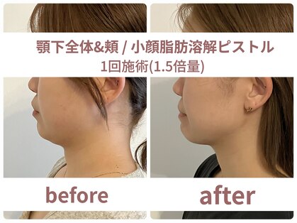 サボラミ(sabor A Mi)の写真