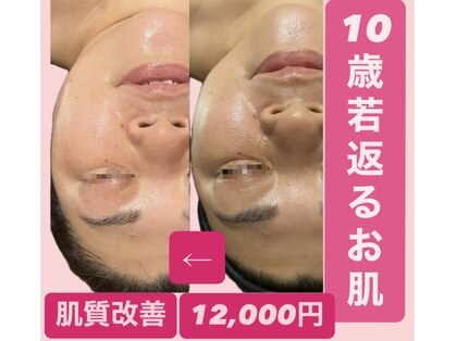 ディサイドロー(DECIDE L.A.W)の写真
