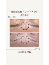 リバイセリー(Revicelly)/比較写真