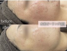 ミレット(Miretto)