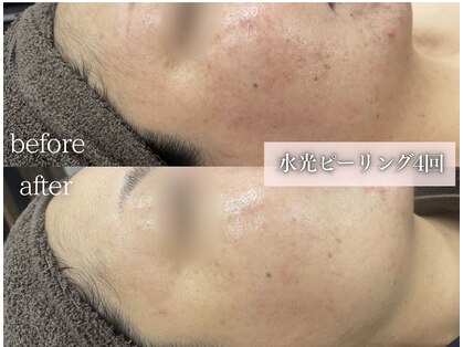 ミレット(Miretto)の写真