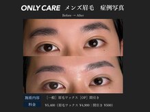 オンリィケア 近大前(ONLY CARE)/【メンズアイブロウ】