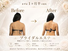 エステティックサロン サロン ド ヴィーナス 新宿店/まずは1ヶ月半の変化写真