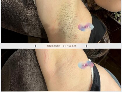 モアトゥインクル 福山神辺店(MORE twinkle)の写真