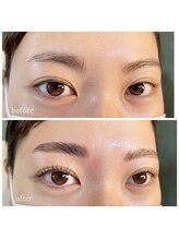 エムアンド(m&)/お目元フルコース