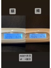 芦屋楓鍼灸院/【スキンチェックを毎回実施◎】