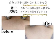 アルゴ 前橋店(ALGO)/ コース開始前→コース１０回