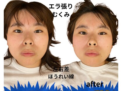 リファイン整体院 国分寺店の写真