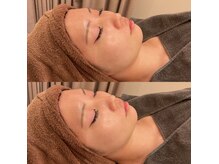 アクトベレッザ(Act BELLEZZA)の雰囲気（マイクロウェーブリフトはフェイシャル、ボディ共に大人気！）