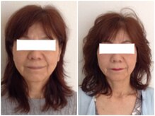 美容整体 ウェリナ 蟹江院/小顔矯正/骨盤矯正/美脚サロン