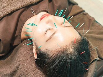 ビアンカ 目黒本院(Bianca)の写真/【10万件を超える施術経験のある実力派店】深いコリも鍼灸で的確にアプローチ！[目黒/鍼灸/美容鍼]