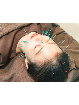 鍼灸施術を受けたい