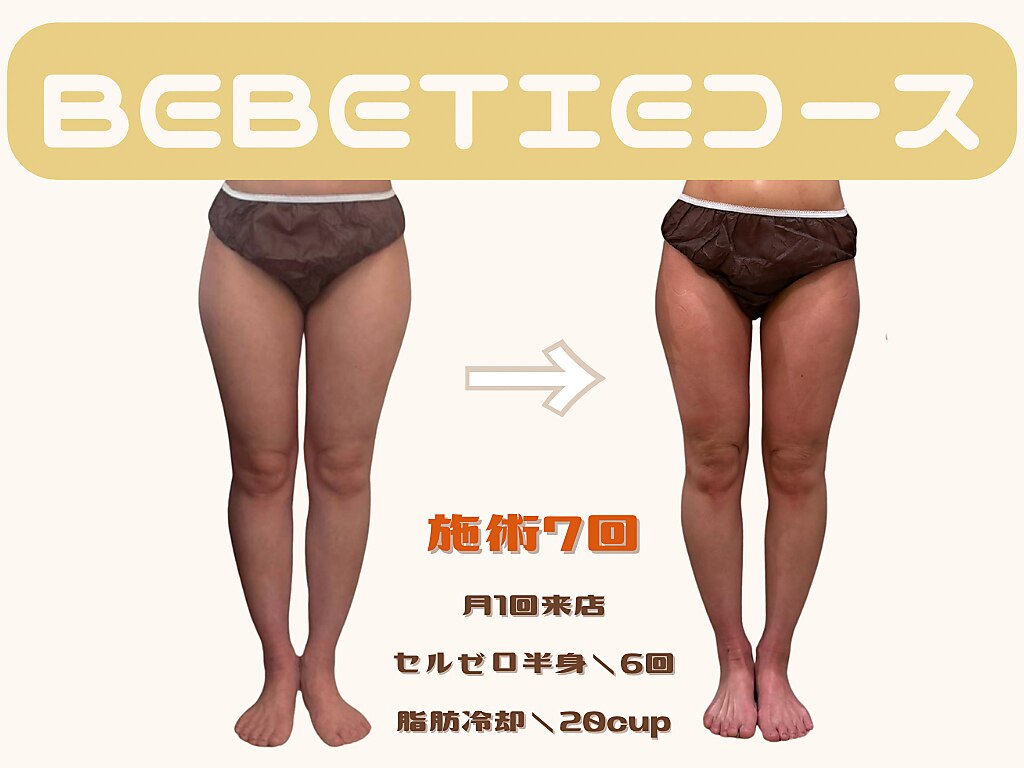 ベベティー(BEBETIE)｜ホットペッパービューティー