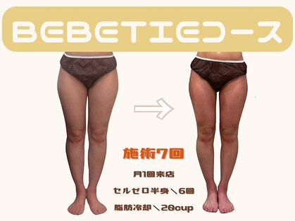 ベベティー(BEBETIE)の写真