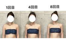 ミヌレ 大阪店(minulle)/続けるとこんなにも変化が！