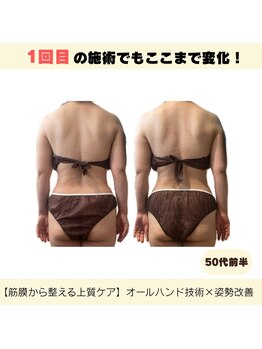 ナーズプラス リベルテ(Naz Plus/Liberte)/筋膜リリース　上半身