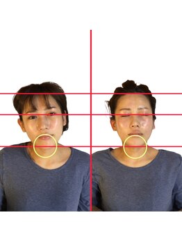 フォルム ボディアンドフェイス 恵比寿(Forme)/顔の歪みは顔の傾きから！