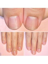 ココデネイル(cocode nail)/悩み:爪が小さい(30代前半)