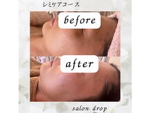 サロン ドロップ 上小田井(Salon drop)の雰囲気（シミケアコース☆）