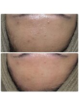 サラン(SALON)/お顔　ビフォー アフター