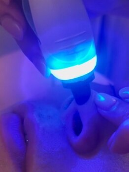 レセラ 銀座店(LE;SERA)の写真/【水素ハイドラフェイシャル】毛穴の汚れごっそり洗浄＆肌つるつる肌育エステ◎透明感あふれる素肌へ♪