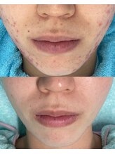 リメイククリニカルビューティー(Remake clinical beauty) 肌悩み最短 改善希望