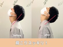 ユアーズ 京都 四条大宮(YOURS)/肩こりスッキリ！