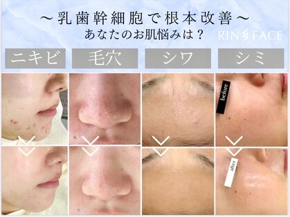 リンフェイス 表参道(RIN FACE)の写真
