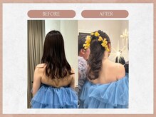 ソウイボディ 武蔵小杉店(Sou-i body)/ブライダルbefore→ after