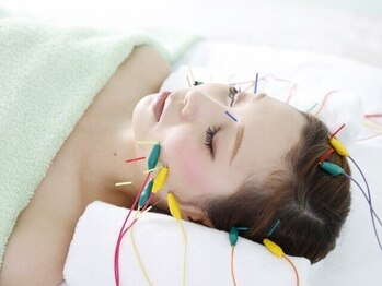 穴田鍼灸整骨院の写真/【育毛促進鍼灸・美容鍼で頭頂部のお悩みにアプローチ！】頭皮に50～100本の鍼を施術し頭皮の血行を促進！