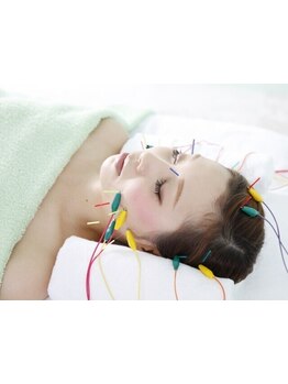 鍼灸施術を受けたい