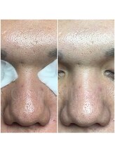 クレアベレッツァ(Crea Bellezza)/何もしてこなかった肌も　OK！