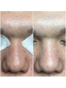 クレアベレッツァ(Crea Bellezza)/何もしてこなかった肌も OK!