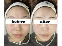 LEDエクステ専門店Fedis【マツエク/まつげパーマ/アイブロウ/フェイシャルワックス】の雰囲気((ツヤ肌)フェイスワックス!)