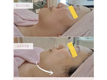 リアウェイク(Reawayke)/レモンボトル1回の効果