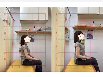はばたき鍼灸整骨院/before/after