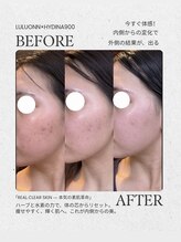 【よもぎ蒸し温活痩身×水素吸入】YOSAPARK ALUA FEM/インナーケアで圧倒的変化