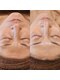 バリーズ(Valley's)の写真/REVI陶肌トリートメントでお肌のハリ・ツヤUP★ターンオーバーを促し、キメを整え透明感のあるお肌へ♪