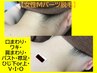 肌悩みも改善☆毛穴レスレディース脱毛　Mパーツ　30分　M¥4400