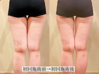 アンジー(Angie)/太ももに隙間が出現