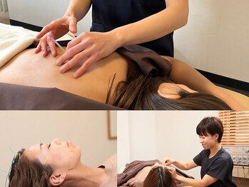 うちだ治療院 烏丸御池の写真/《鍼灸・指圧マッサージ師》によるフルメンテナンスで、心身を快適に健やかに整えます【烏丸御池/丸太町】