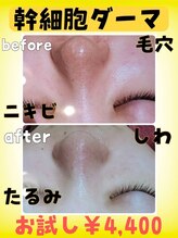 ジョリエプランセス/幹細胞エステダーマ