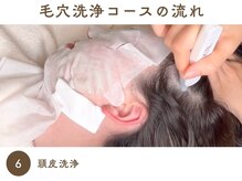 ファン(FAN)/毛穴洗浄 《施術の流れ》