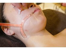 アンジェロ/【小顔】脂肪分解